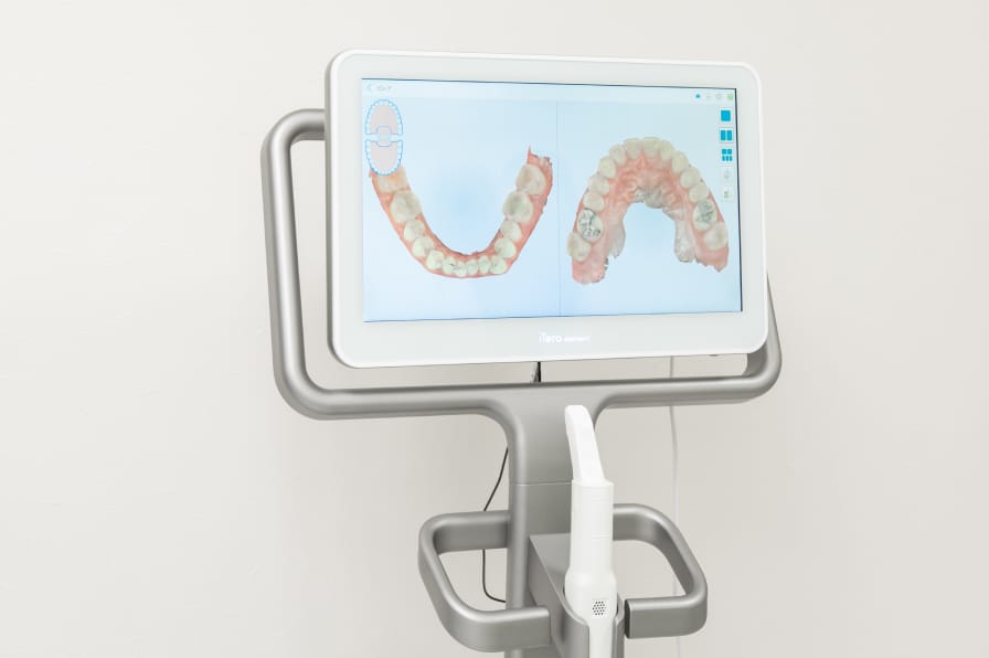 口腔内3Dスキャナー（iTero）